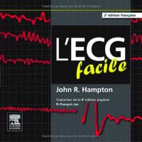 Ecg Facile 2e Edition